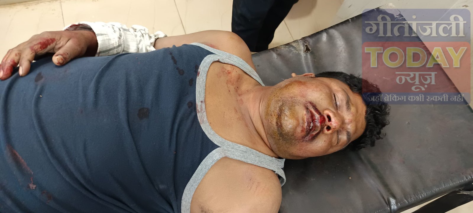 तेज रफ्तार रॉयल बस की चपेट में युवक गंभीर रूप से घायल पुलिस ने बस जब्त कर शुरू की जांच