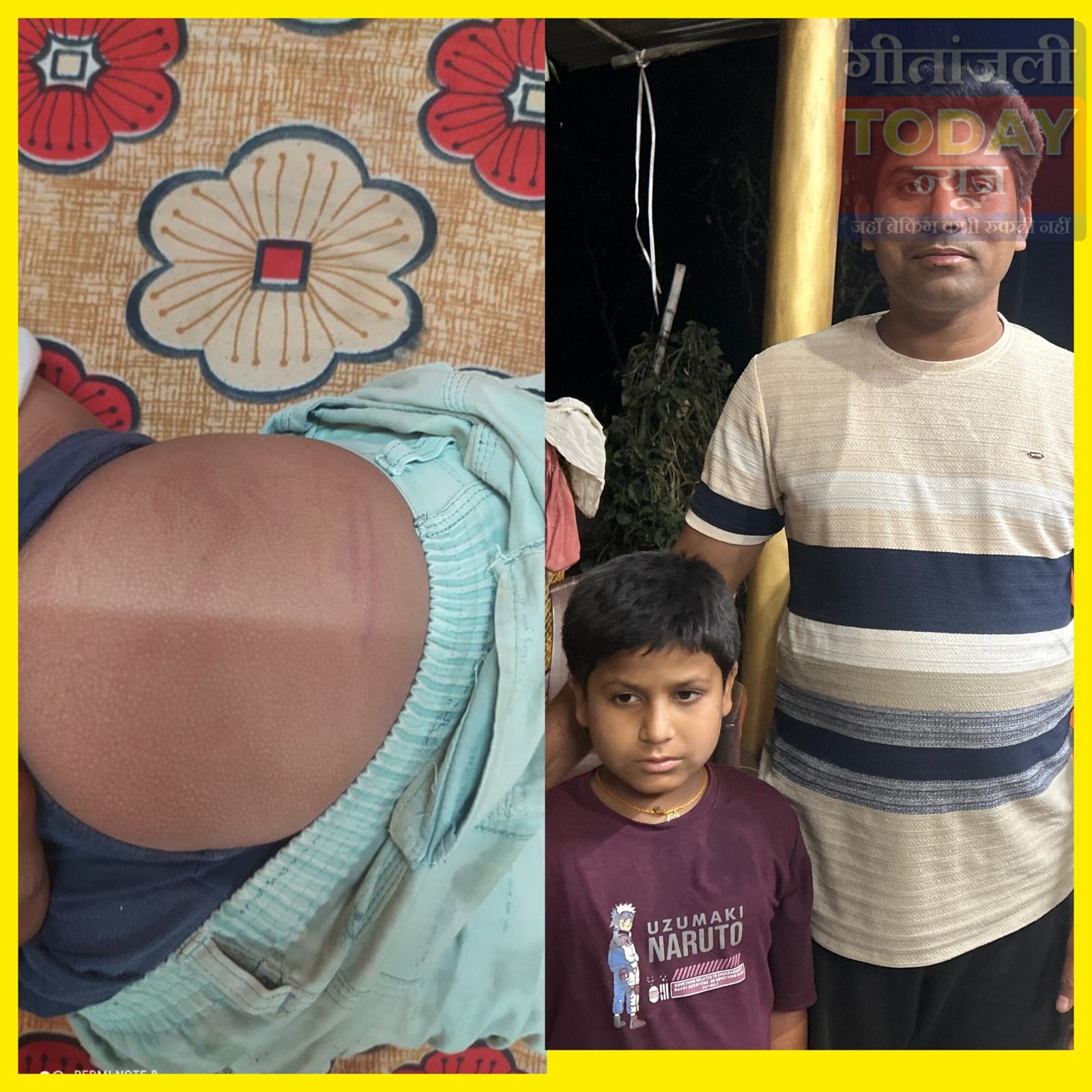 शिकायत करना पड़ा भारी: तीसरी के छात्र की पिटाई का आरोप, स्कूल प्रबंधन ने नकारा